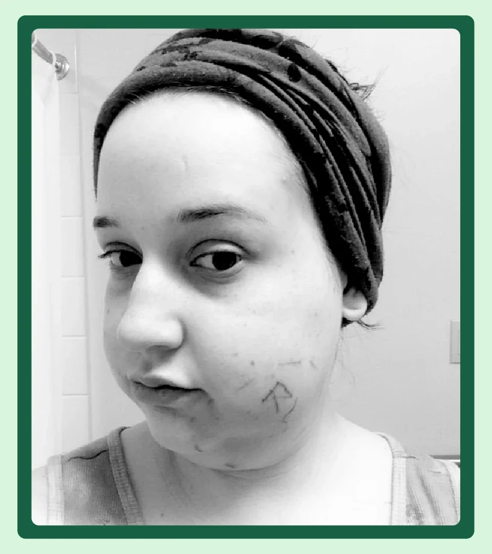 Crohn's: PEx: Quote: Pic