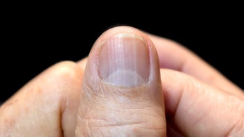 Dermatology: closeup lunula on nail 1449529907
