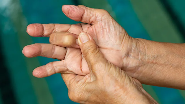movement exercise: closeup trigger finger stretch 1159180723