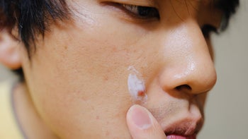 Differin gel: close-up applying cream on pimple 1310279288