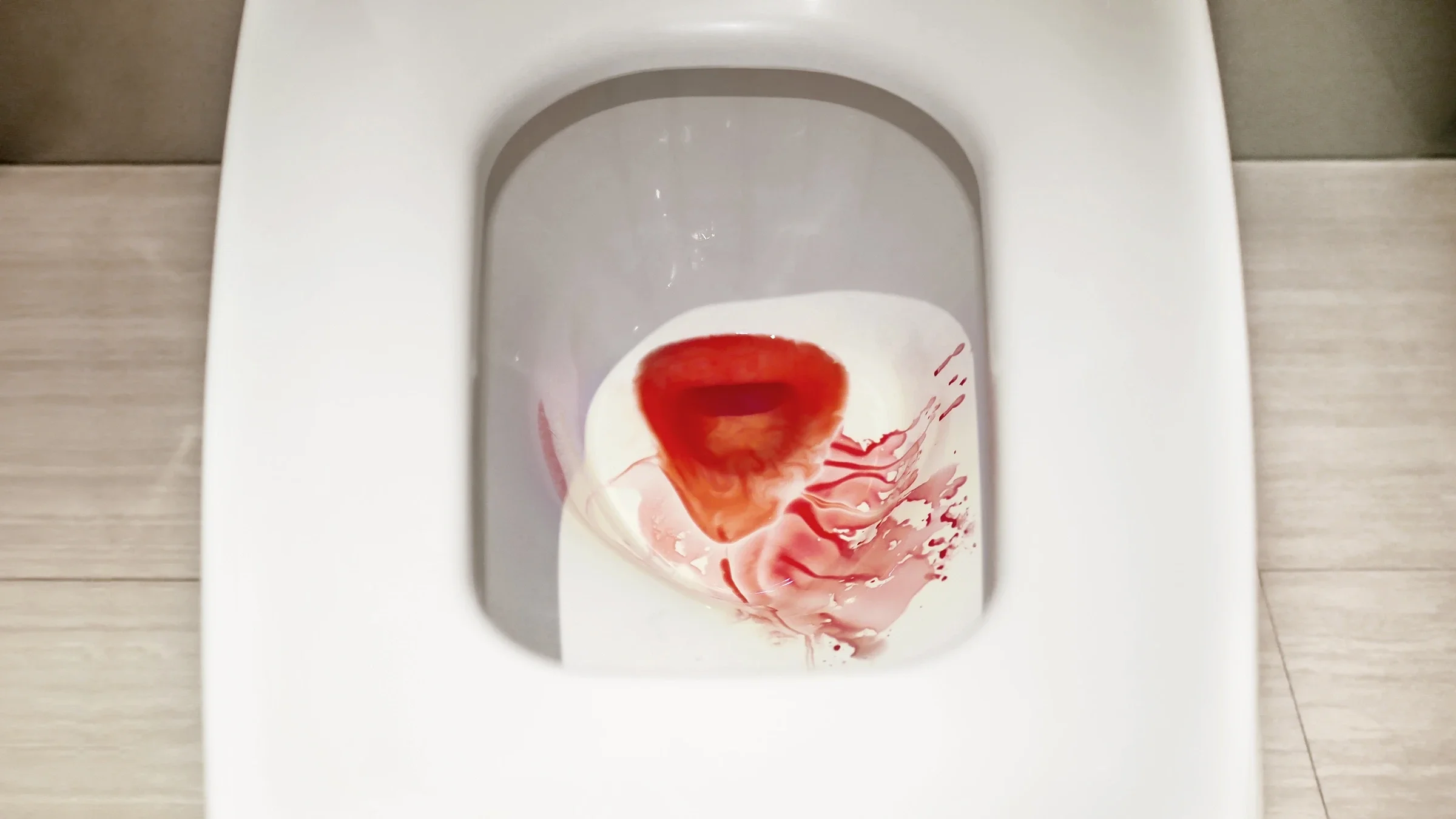Blood in a toilet bowl.