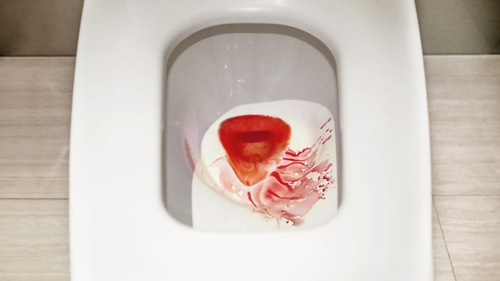 Blood in a toilet bowl.