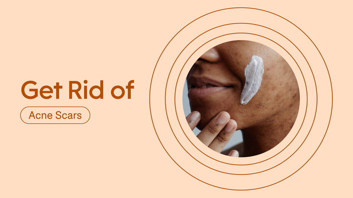 can i get rid of acne scars in a week