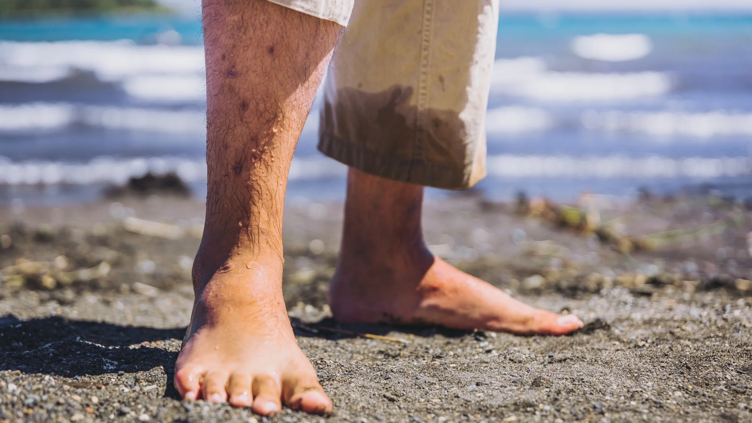 Cropped shot of a person with keratosis pilaris on the beach.