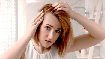Health: Ozempic: thinning hair woman concerned 1320296796