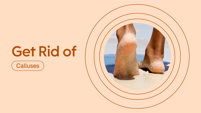 3 People Share How They Got Rid of Calluses on Their Feet - GoodRx