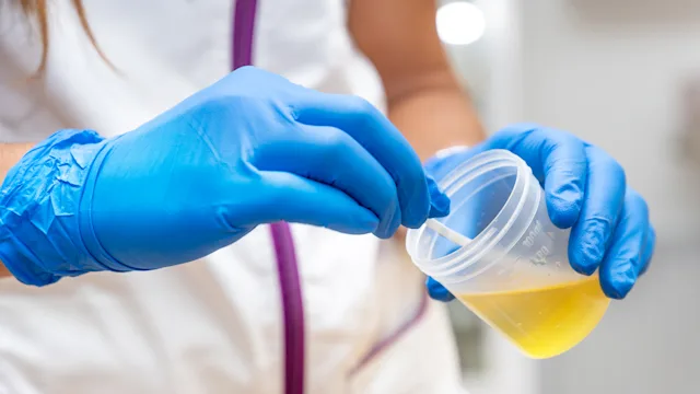 Urology: closeup urine specimen 1840361972