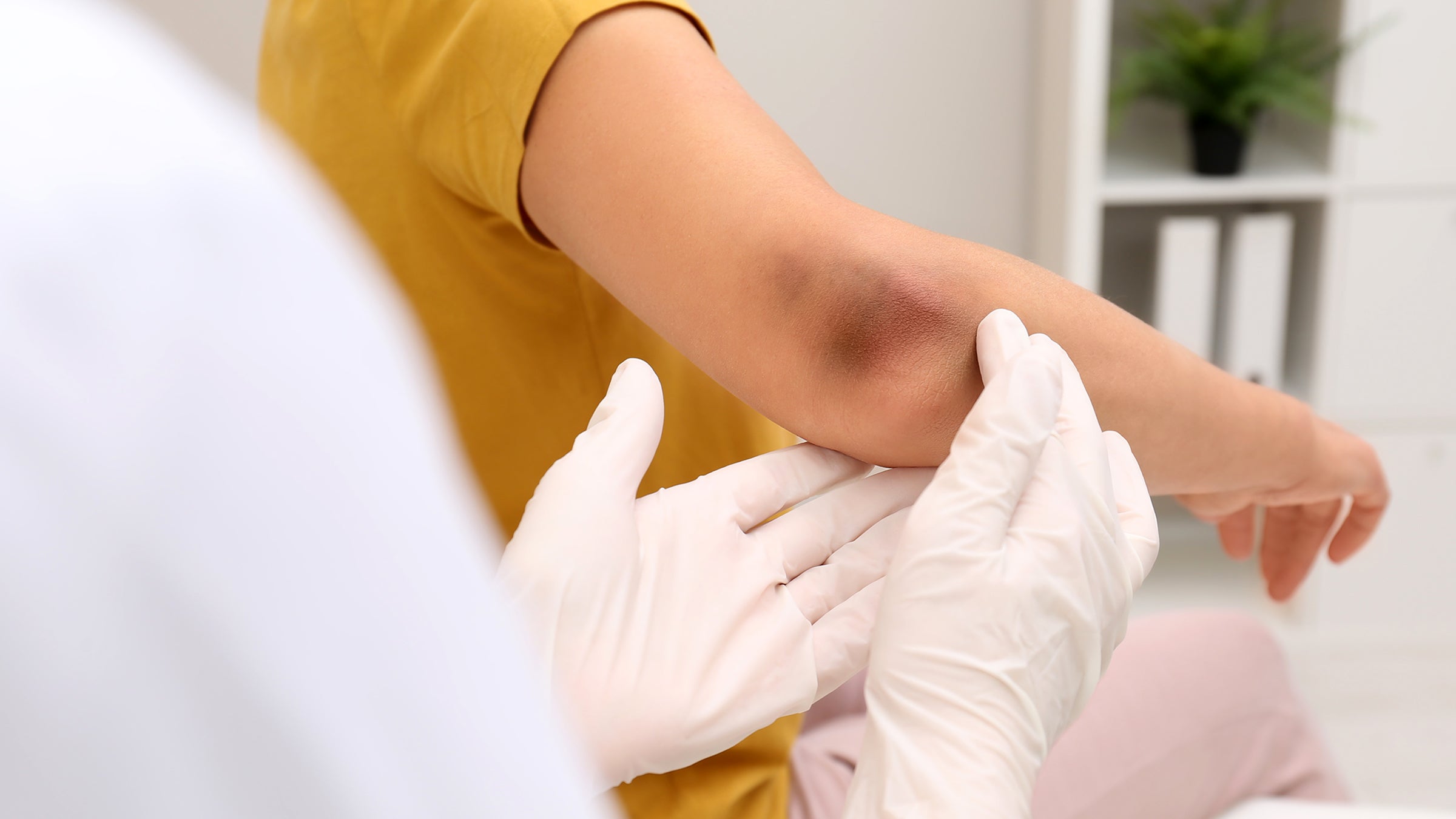 Eliquis (apixaban) Basics, Side Effects & Reviews