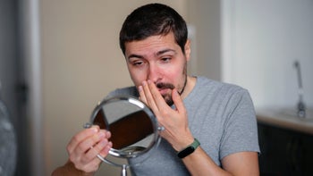 Cold Sores: man looking at face in mirror 1389300663