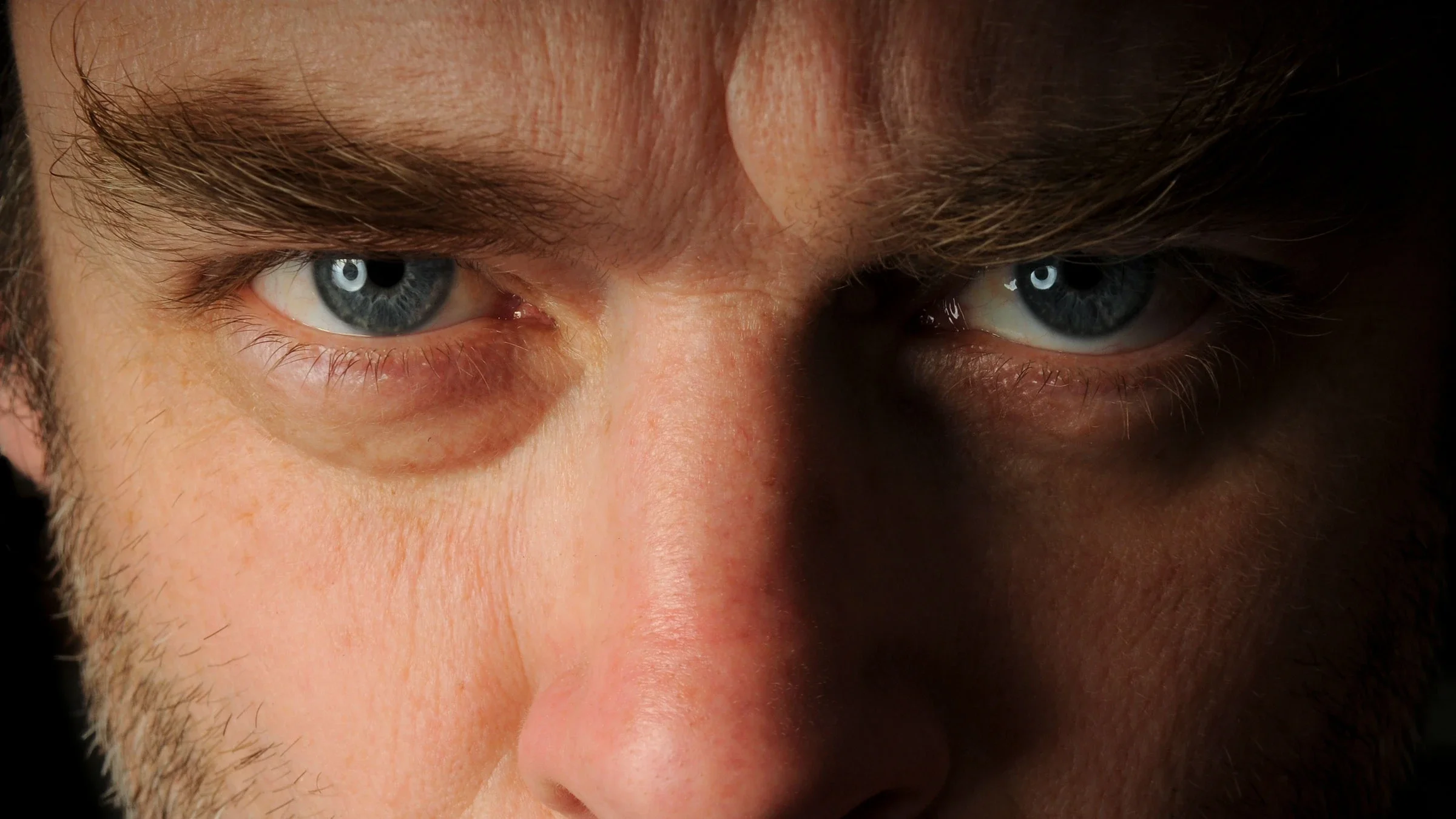 A man has a stern look in his eyes. Studies suggest that people who use anabolic-androgenic steroids show irritability and unprovoked aggression.