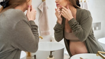 acne: pregnant popping pimple 1989803394