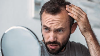 men's health: hair loss: man looking at hairline in mirror 1040532764