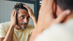 Learn about the differences between topical vs. oral finasteride for hair loss.
