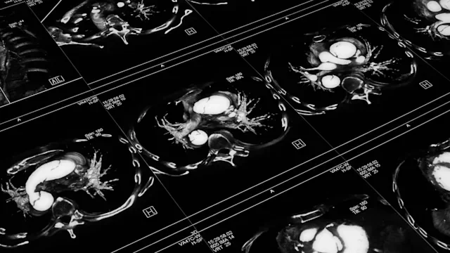 Health: Heart health: GettyImages 92666607 BW