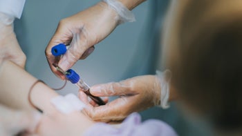 HCP: Hematology: drawing blood closeup 1303315827