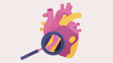 Top 19 when to see a cardiologist 1 When to See a Cardiologist