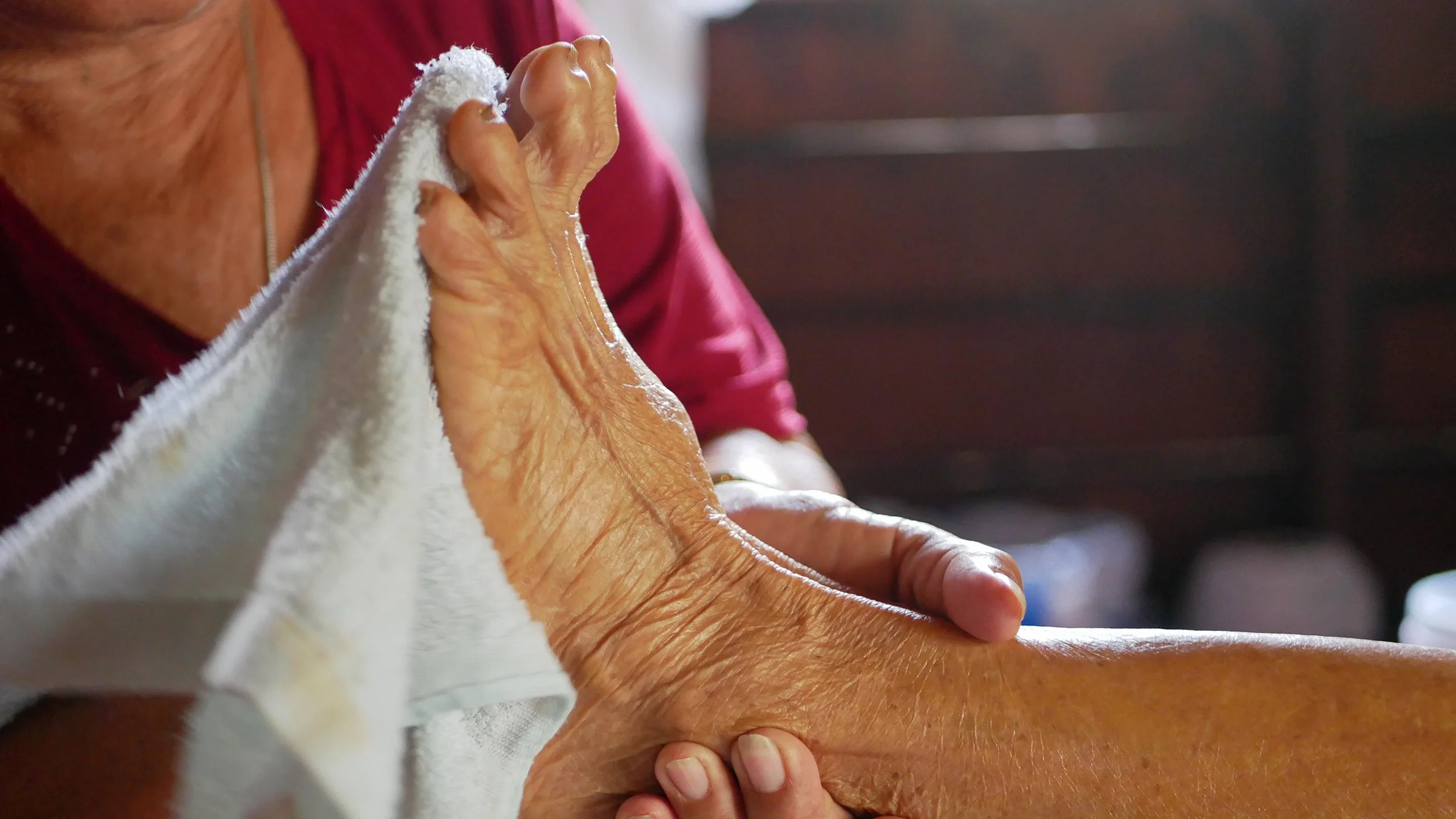 A close-up on an older woman's foot with a claw toe. A nurse is cleaning her feet.