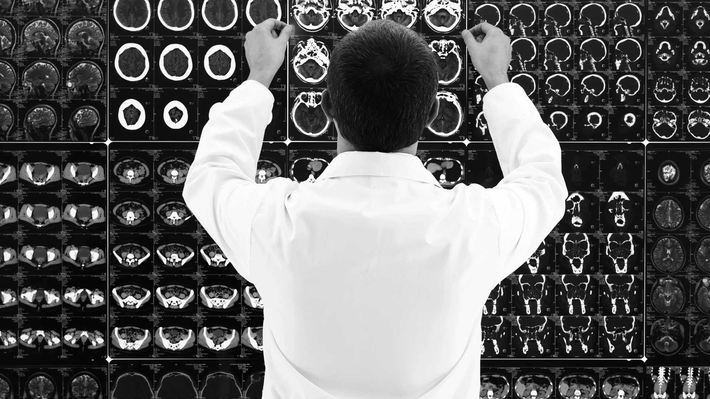Black-and-white rear view of a doctor looking at MRI scans on the light-box wall.