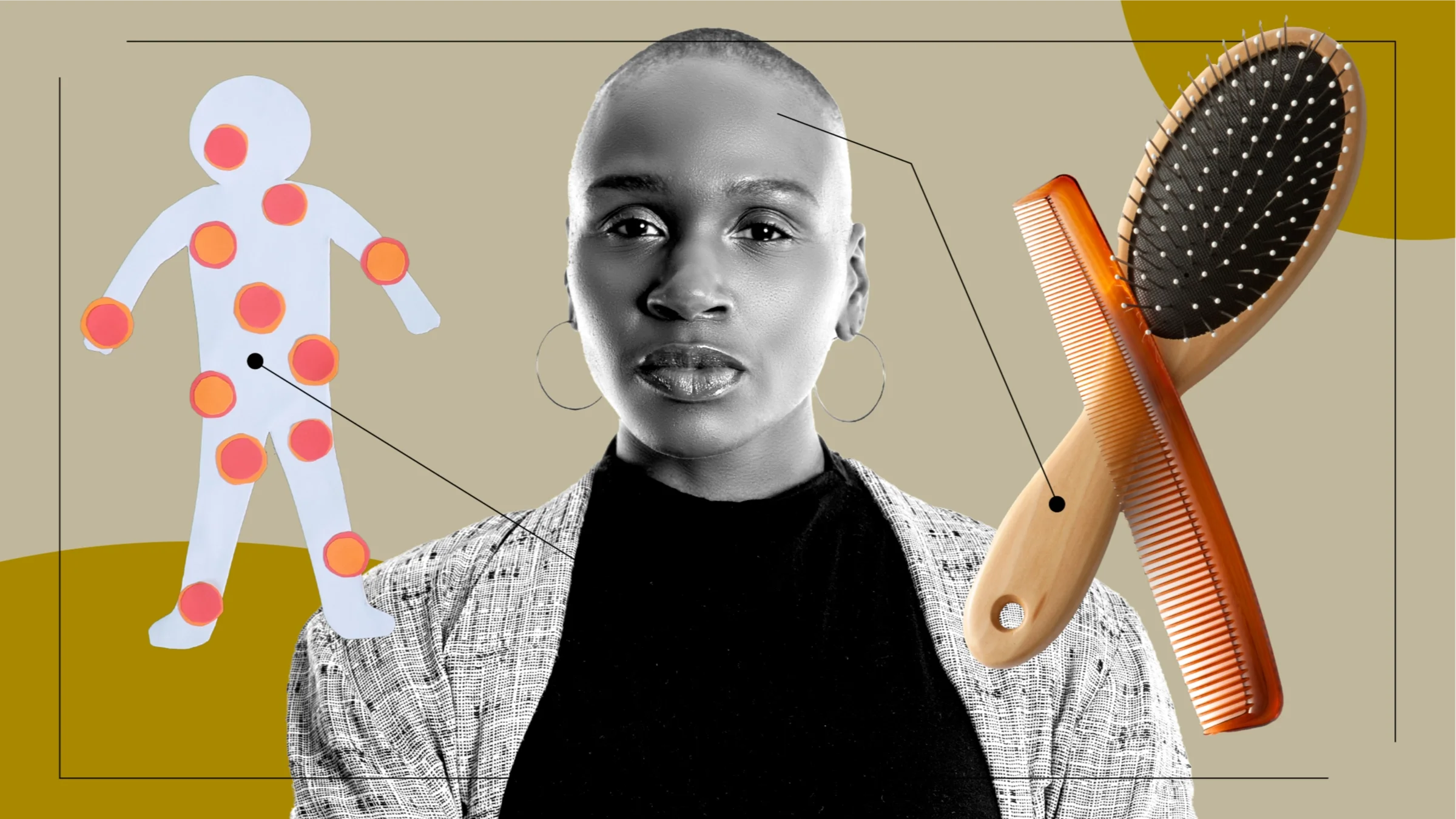 A graphic shows a portrait of a woman surrounded by images representing what lupus feels like: a set of brushes and a cutout showing pain points on the body.