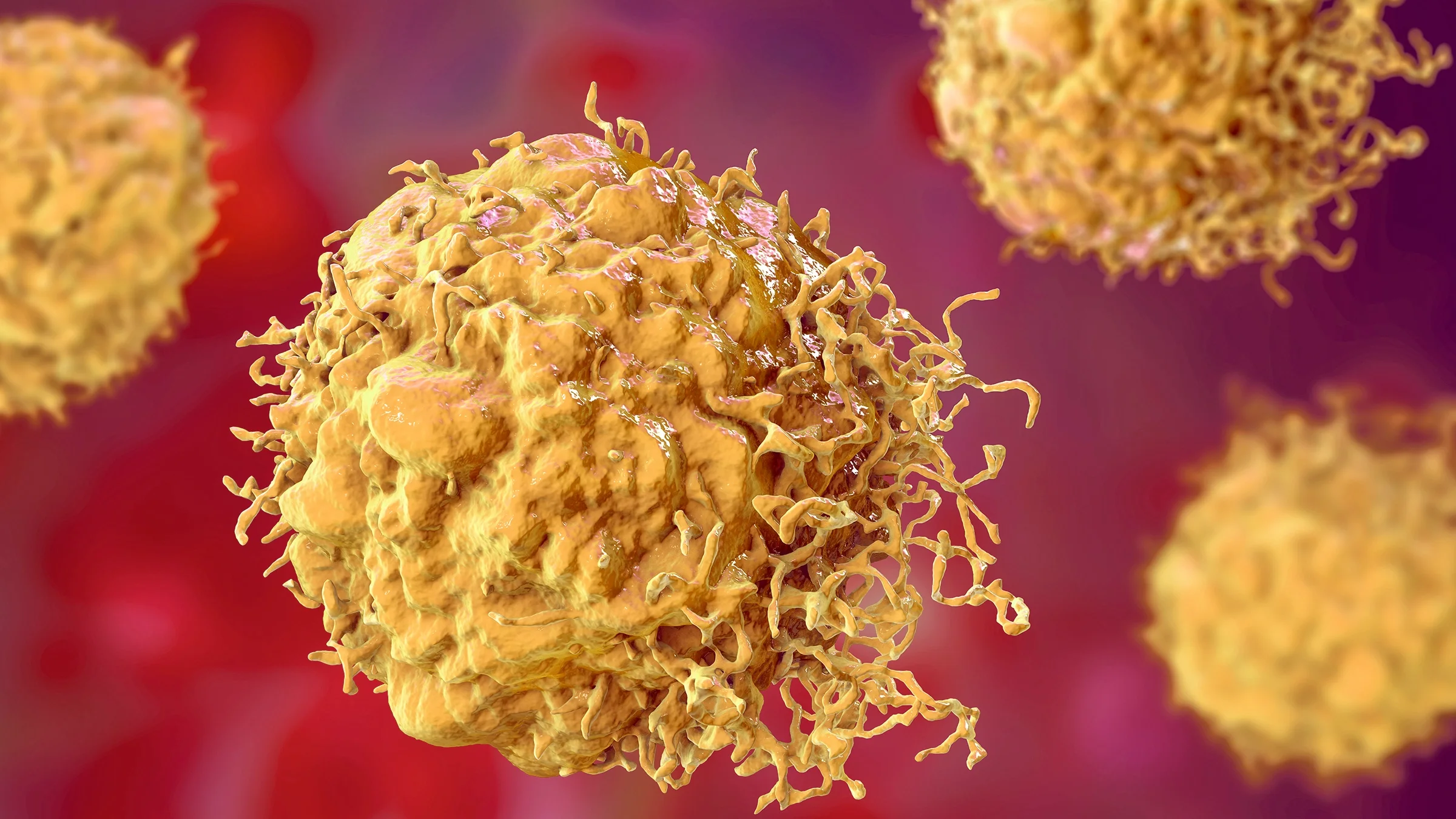 A 3D microscopic picture of cancer cells. The cells are yellow and the background is pinkish red.