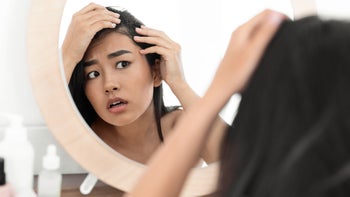 spironolactone: checking hairline in mirror 1256496811