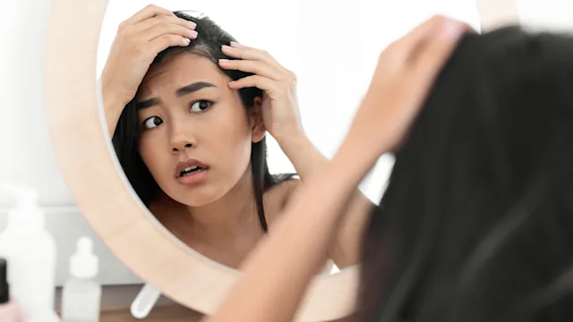 spironolactone: checking hairline in mirror 1256496811