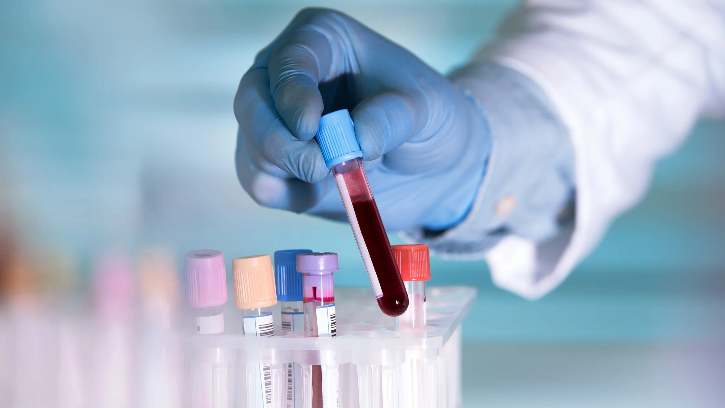 Close-up of a lab technician grabbing a blood sample from a test tube tray.