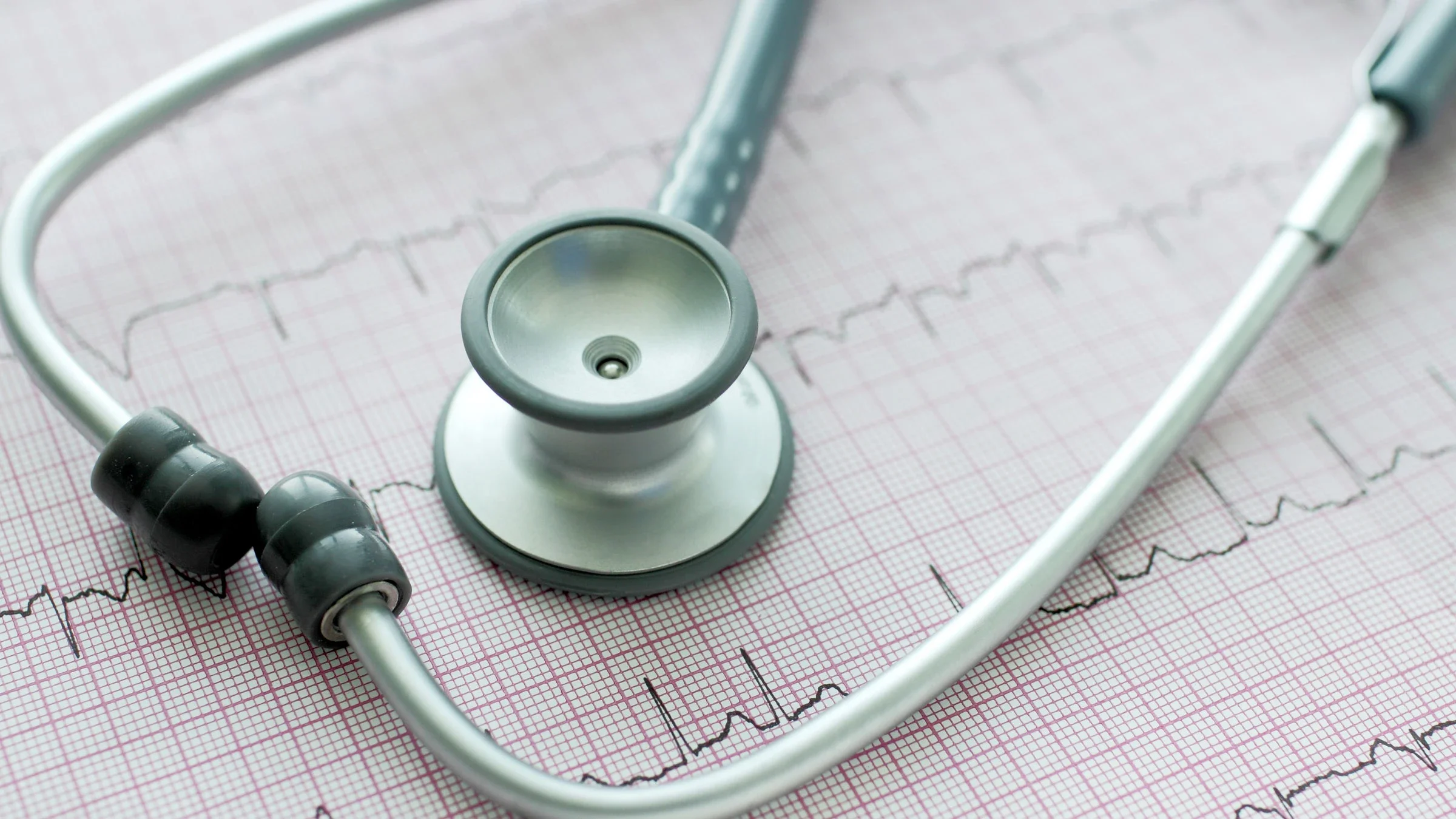 Atrial fibrillation: close up stethoscope ECG 473291878