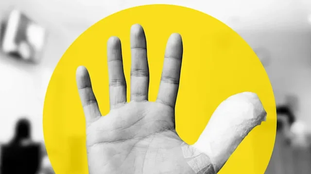 Conditions: Wound Care: GettyImages 1128431180 BW