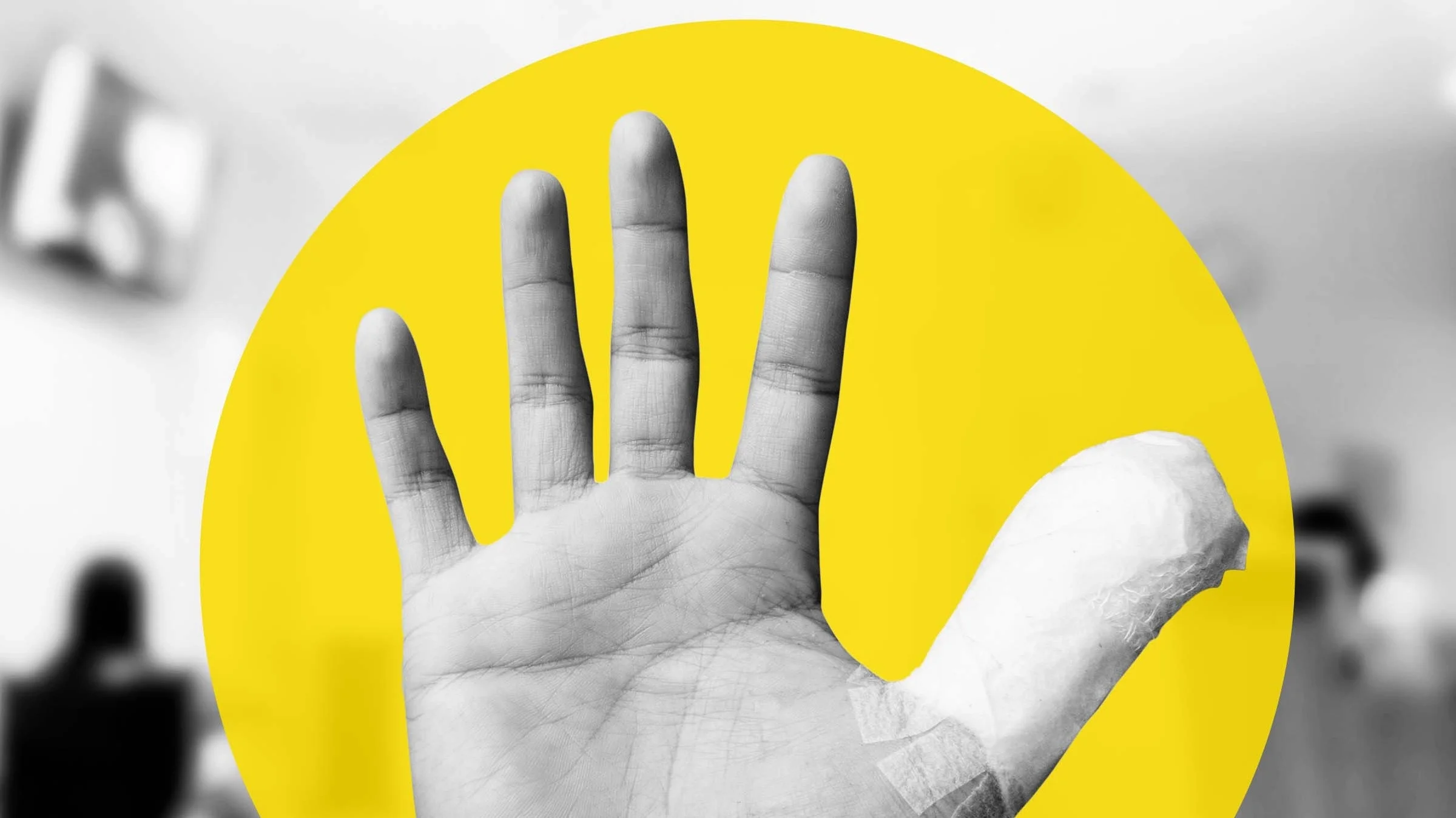 Black and white close-up of a person's hand with a bandage on their thumb. There is a large yellow circle graphic in the background that was added.