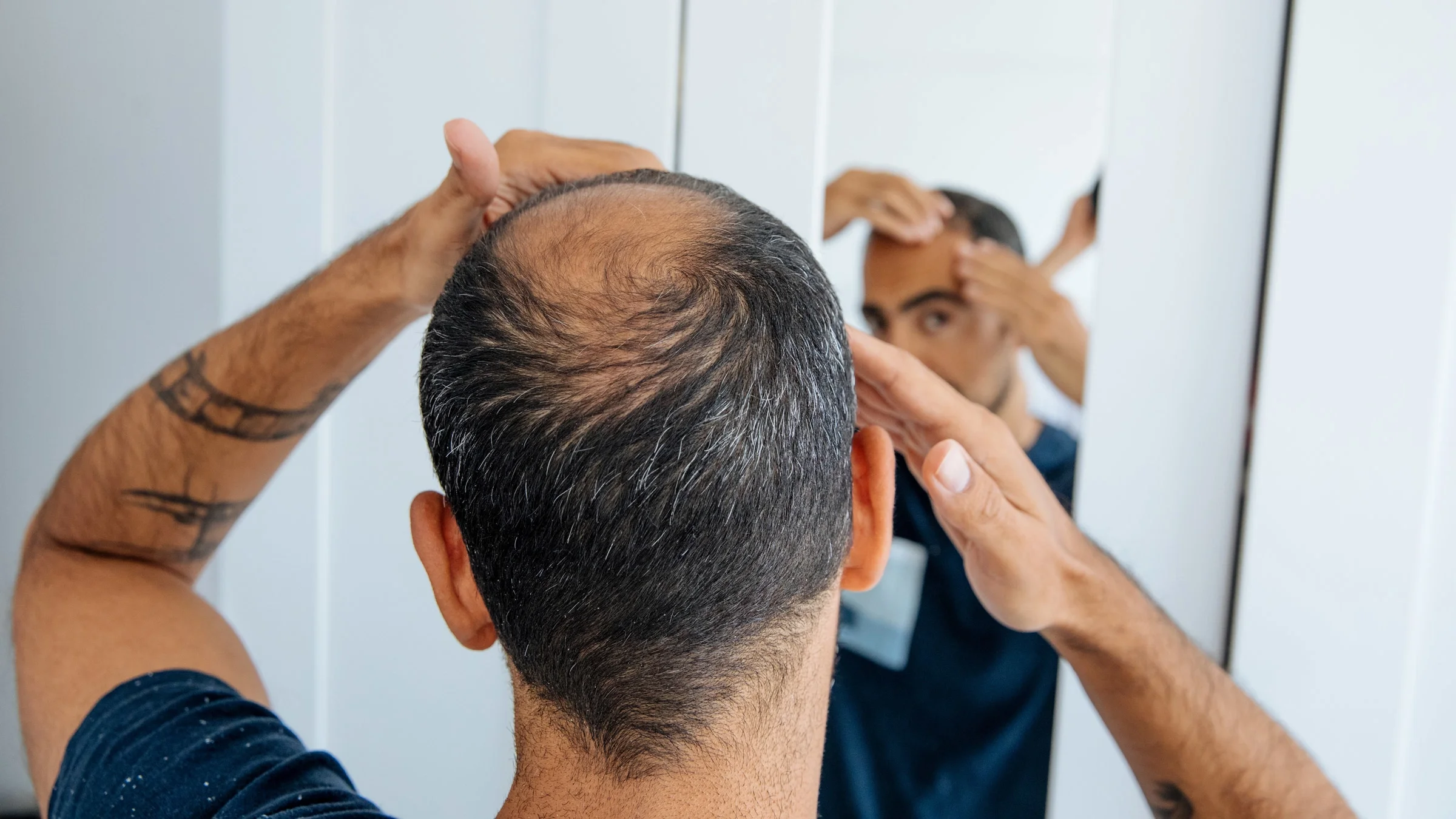 A balding person checking their hairline in the mirror.