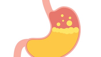 diagnosing-gastroesophageal-reflux-disease-scaled.jpg