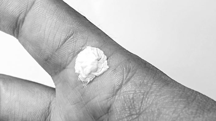 Close-up of salicylic acid cream covering a wart on a person's pointer finger.