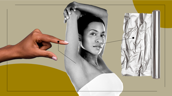 Patient experiences: patient stories feel laser hair removal option 2