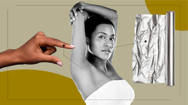 Patient experiences: patient stories feel laser hair removal option 2