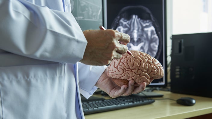 A doctor explaining MRI results using a model of a brain.