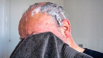 Health: Hair loss: senior man balding shower treatment-1278291856