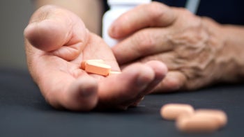 Health: Psoriatic arthritis: GettyImages 497595451