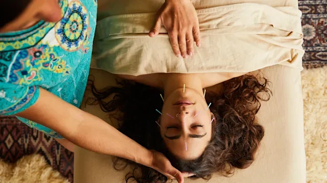 allergies: woman at accupuncture 1185864911