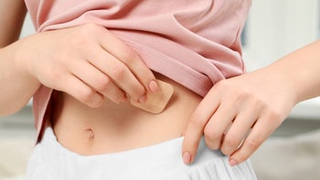 Birth Control: closeup woman applying contraceptive patch 1780786788