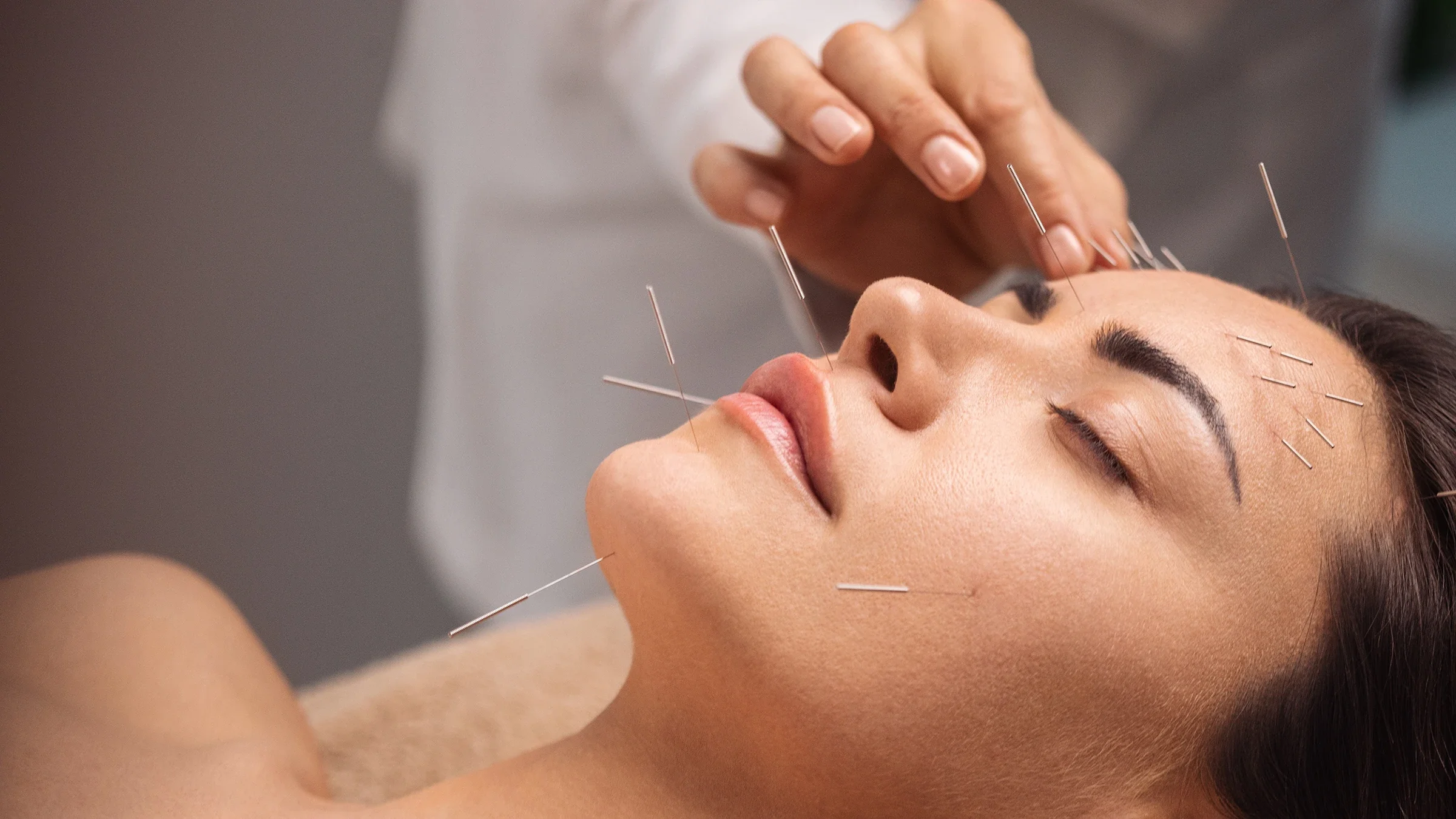 Health: allergies: facial acupuncture-1356339790