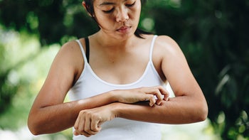 Health: Autoimmune: GettyImages-1032681556