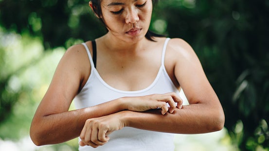 Young woman outside scratching her forearm.