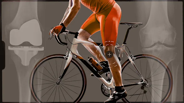 PEx: surgery knee 2-01