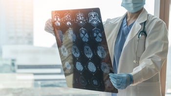 Seizure: reviewing mri scans 1313194220