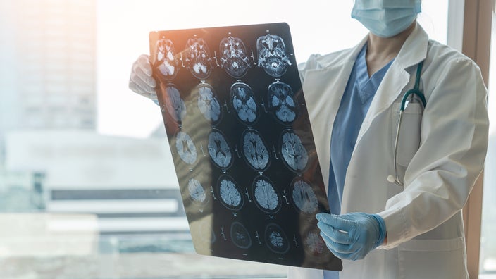 Cropped shot of a doctor reviewing brain scans.