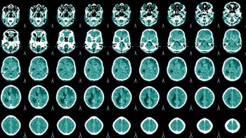 Compare Japanese Encephalitis Medication Prices for Brand and ...