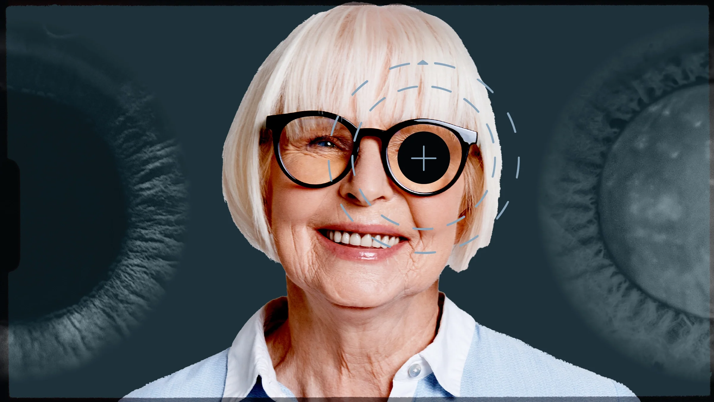 Custom graphic with a portrait of a senior woman in the center. On her eye there is a diagram circle pointer showing the surgery area. On either side of her are the before and after images of cataract surgery. 