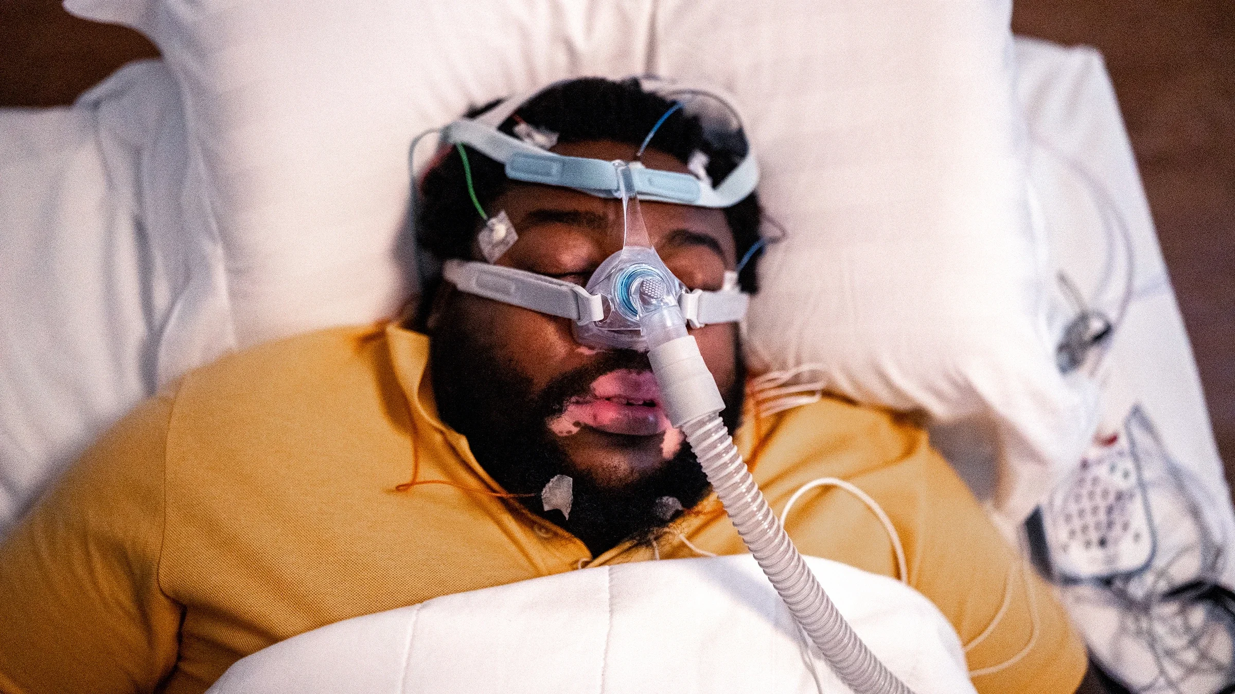 An adult is sleeping with a device to test for sleep apnea.
