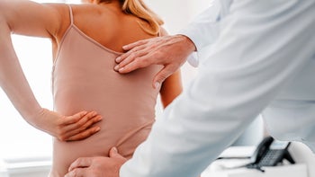 ankylosing spondylitis: closeup doctor examining spine 1266812394
